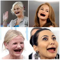 Actresses Without Teeth