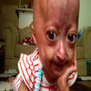Adalia Rose Adalia Rose