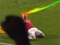 Lasers