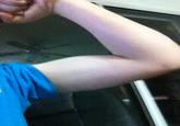 Big Arm Kid