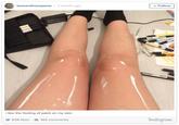 The Legs