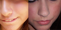 Boxxy